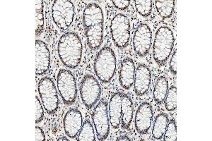 IHC analysis of SNRNP40 using anti-SNRNP40 antibody (ABIN7601719). (SNRNP40 anticorps  (AA 43-357))