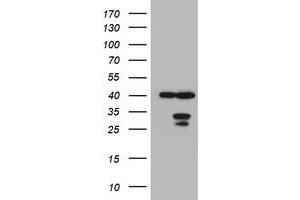 Image no. 1 for anti-Mitochondrial Translational Initiation Factor 3 (MTIF3) (AA 56-278) antibody (ABIN1491592) (MTIF3 anticorps  (AA 56-278))