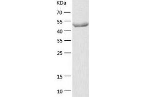 GDP Dissociation Inhibitor 1 (GDI1) (AA 1-447) protein (His-IF2DI Tag)