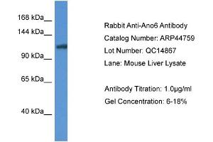 WB Suggested Anti-Ano6 Antibody   Titration: 1. (Anoctamin 6 anticorps  (Middle Region))
