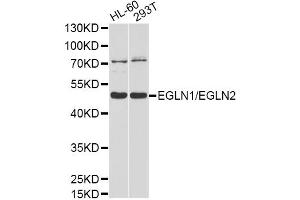 Western blot analysis of extracts of various cell lines, using EGLN1/EGLN2 antibody (ABIN4903548) at 1:1000 dilution. (EGLN1 anticorps)
