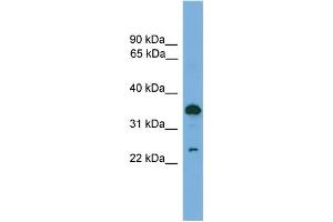 WB Suggested Anti-TPD52 Antibody Titration:  0. (TPD52 anticorps  (C-Term))