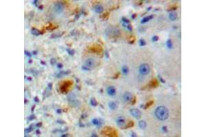 IHC-P analysis of Liver tissue, with DAB staining. (DCL1 anticorps  (AA 23-232))