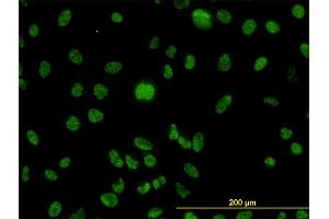 Immunofluorescence of monoclonal antibody to MLH1 on HeLa cell.