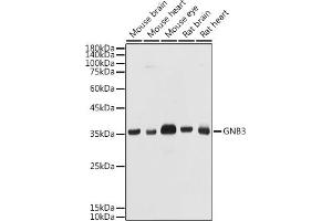 Western blot analysis of extracts of various cell lines, using GNB3 antibody (ABIN1680055, ABIN3015467, ABIN3015468 and ABIN6218020) at 1:1000 dilution.