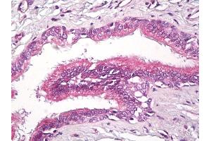 Anti-RAP2 antibody IHC of human lung, respiratory epithelium.