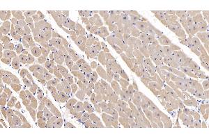 Detection of MYH2 in Human Cardiac Muscle Tissue using Polyclonal Antibody to Myosin Heavy Chain 2 (MYH2) (MYH2 anticorps  (AA 1237-1471))