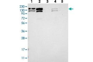 Western blot analysis of Lane 1: RT-4, Lane 2: U-251 MG, Lane 3: Human Plasma, Lane 4: Liver, Lane 5: Tonsil with CCAR1 polyclonal antibody . (CCAR1 anticorps)