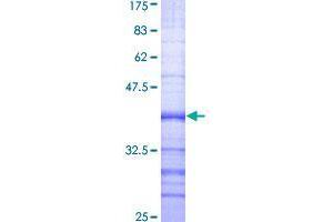 Image no. 1 for BMP2 Inducible Kinase (BMP2K) (AA 540-650) protein (GST tag) (ABIN1346757)