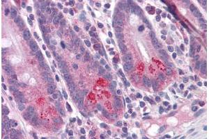 Human Small Intestine: Formalin-Fixed, Paraffin-Embedded (FFPE) (BIRC6 anticorps  (C-Term))