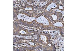 IHC analysis of HSD17B7 using anti-HSD17B7 antibody (ABIN7600174). (HSD17B7 anticorps  (AA 16-336))