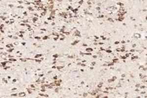 Immunohistochemistry analysis of paraffin-embedded mouse brain using,RPL10 (ABIN7075428) at dilution of 1: 4000