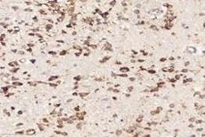Immunohistochemistry analysis of paraffin-embedded mouse brain using,RPL10 (ABIN7075428) at dilution of 1: 4000 (RPL10 anticorps)
