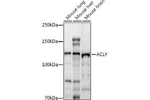 Western blot analysis of extracts of various cell lines, using ACLY antibody (ABIN7265716) at 1:1000 dilution.