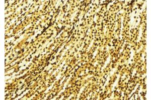 ABIN6269316 at 1/100 staining Human gastric tissue by IHC-P.