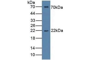 Rabbit Detection antibody from the kit in WB with Positive Control:  Sample Human serum. (IL1RAP Kit ELISA)