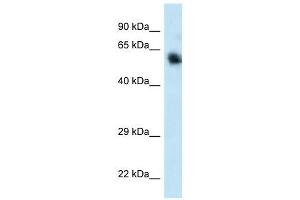 Western Blot showing CAMKK1 antibody used at a concentration of 1.