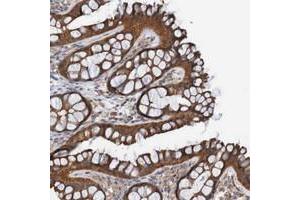 Immunohistochemical staining of human colon with ST8SIA6 polyclonal antibody  shows strong cytoplasmic positivity in glandular cells at 1:50-1:200 dilution. (ST8SIA6 anticorps)