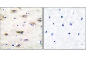 Immunohistochemistry analysis of paraffin-embedded human brain tissue, using GluR2 (Ab-880) Antibody. (GRIA2 anticorps  (AA 834-883))