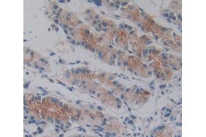 Used in DAB staining on fromalin fixed paraffin- embedded stomach tissue (Tensin 1 anticorps  (AA 4-307))
