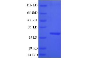 SDS-PAGE (SDS) image for Cathepsin K (CTSK) (AA 115-329) protein (His tag) (ABIN5709361)