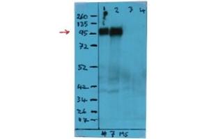 Western Blot analysis using CD107a / LAMP1 Antibody Cat.