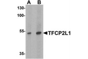 Western blot analysis of TFCP2L1 in human colon tissue lysate with TFCP2L1 antibody at (A) 1 and (B) 2 ug/mL (TFCP2L1 anticorps  (N-Term))