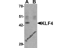Western Blotting (WB) image for anti-Kruppel-Like Factor 4 (Gut) (KLF4) antibody (ABIN1031709) (KLF4 anticorps)