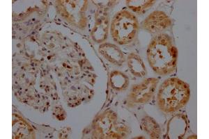 IHC image of ABIN7127810 diluted at 1:100 and staining in paraffin-embedded human kidney tissue performed on a Leica BondTM system. (Recombinant SIRT5 anticorps)