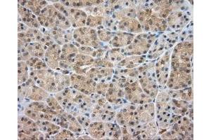 Immunohistochemical staining of paraffin-embedded liver tissue using anti-SRR mouse monoclonal antibody. (SRR anticorps)