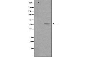 Western blot analysis of extracts of various cell lines, using MSR1 antibody. (Macrophage Scavenger Receptor 1 anticorps  (N-Term))