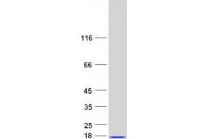 Validation with Western Blot