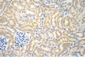 Immunohistochemistry was performed on paraffin-embedded mouse kidney using NFKB1 antibody (ABIN7799638), 1:200).