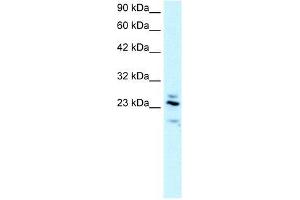 Human brain; WB Suggested Anti-RGS20 Antibody Titration: 2.