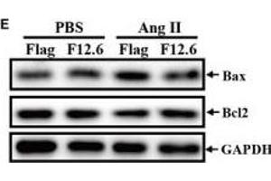 Overexpression of FKBP12.
