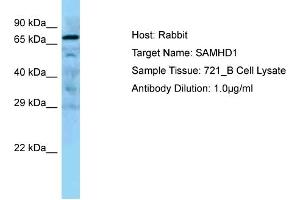 WB Suggested Anti-SAMHD1 Antibody Titration: 0. (SAMHD1 anticorps  (Middle Region))