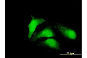 Immunofluorescence of purified MaxPab antibody to CDCA8 on HeLa cell. (CDCA8 anticorps  (AA 1-280))