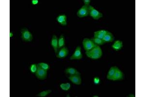 Immunofluorescence staining of HepG2 cells with ABIN7143477 at 1:100, counter-stained with DAPI. (ARL11 anticorps  (AA 2-196))
