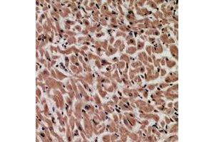 Immunohistochemical analysis of MYCBP staining in human heart formalin fixed paraffin embedded tissue section. (MYCBP anticorps)