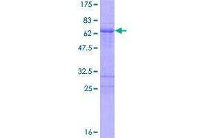 Image no. 1 for Paired-Like Homeobox 2a (PHOX2A) (AA 1-284) protein (GST tag) (ABIN1314942)
