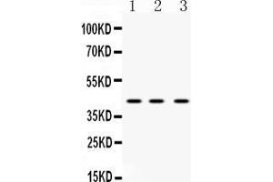 Western blot analysis of HnRNP F expression in rat liver extract ( Lane 1), mouse spleen extract ( Lane 2) and HELA whole cell lysates ( Lane 3). (HNRNPF anticorps  (N-Term))