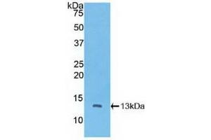 Detection of Recombinant CTNNbIP1, Human using Polyclonal Antibody to Catenin Beta Interacting Protein 1 (CTNNbIP1)