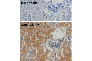 Immunohistochemistry (IHC) image for anti-CD19 Molecule (CD19) (C-Term) antibody (ABIN6254219)