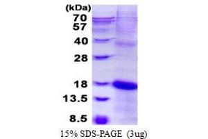 Image no. 1 for Killer Cell Lectin-Like Receptor Subfamily C, Member 2 (KLRC2) (AA 94-231) protein (His tag) (ABIN1098669)
