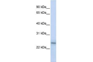 WB Suggested Anti-PSMB9 Antibody Titration:  0. (PSMB9 anticorps  (C-Term))