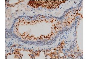 ABIN6267385 at 1/200 staining Mouse lung tissue sections by IHC-P.