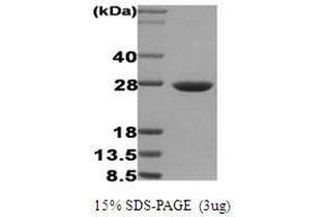Figure annotation denotes ug of protein loaded and % gel used. (HSP27 Protéine)