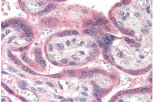 anti-Anterior Pharynx Defective 1 Homolog A (C. Elegans) (APH1A) (N-Term) antibody