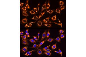 Immunofluorescence analysis of NIH/3T3 cells using  Rabbit pAb (ABIN6129864, ABIN6136458, ABIN6136459 and ABIN6222564) at dilution of 1:100 (40x lens).