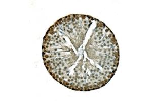 IHC analysis of LSM8 using anti-LSM8 antibody (ABIN7599579). (NAA38 anticorps  (AA 1-96))